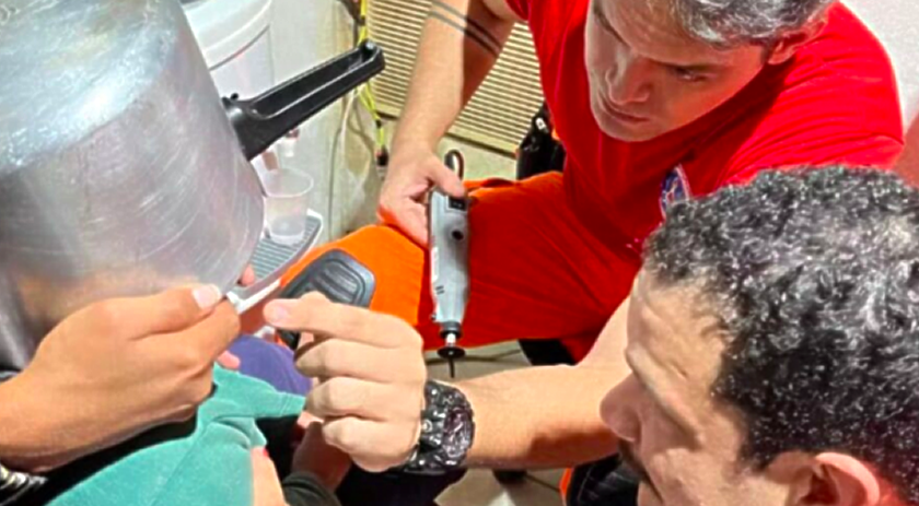 Criança passa mais de uma hora com panela de pressão presa na cabeça e mobiliza bombeiros
