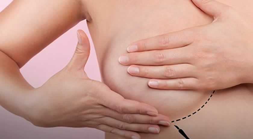 Tratamento pode fazer câncer de mama regredir seis vezes mais rápido