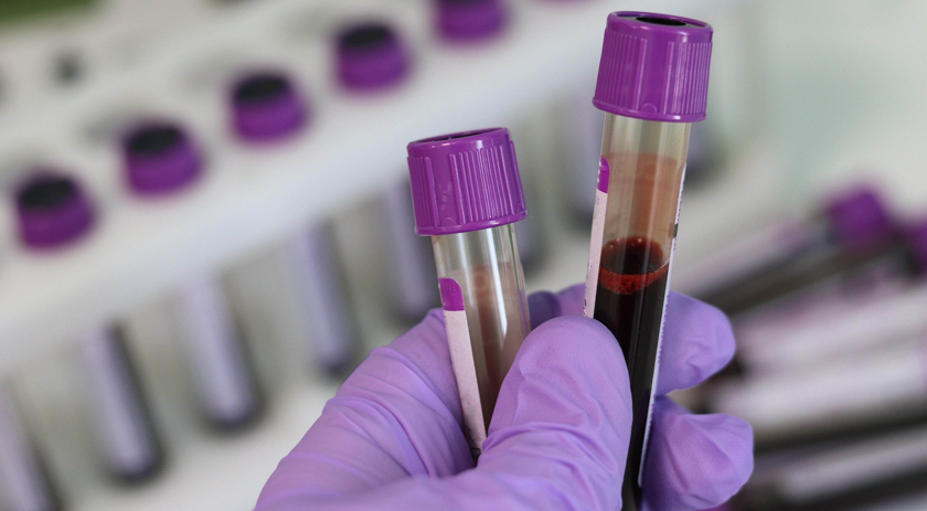 Alerta para o diagnóstico precoce de anemia e leucemia, doenças ligadas ao sangue