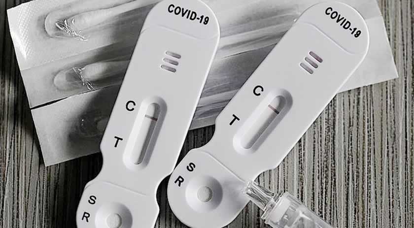 Farmácias começam a vender autotestes de Covid-19 nos próximos dias
