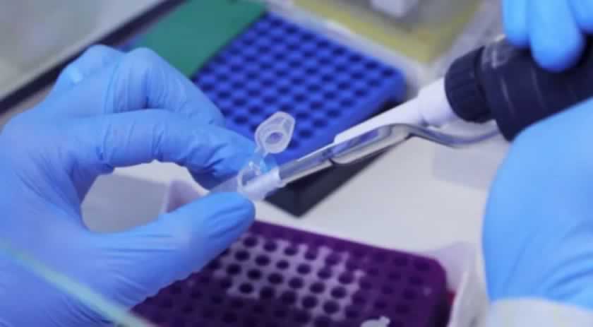 Fiocruz alerta para alta de casos de covid-19 em quatro estados