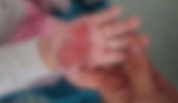 Madrasta choca com crueldade contra criança de apenas dois anos